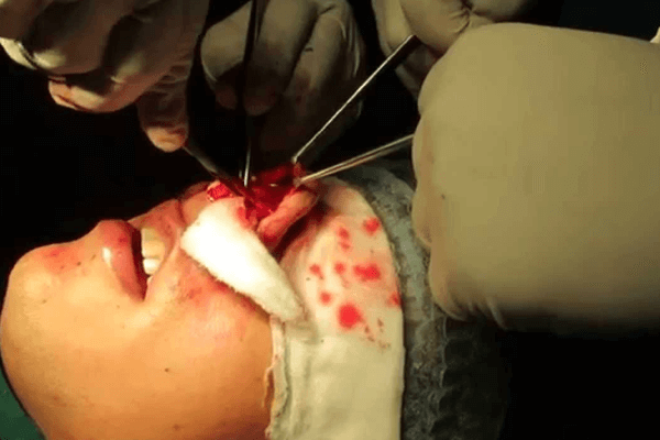 Plastic Surgery