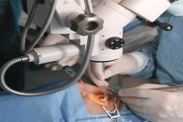 Opthalmology