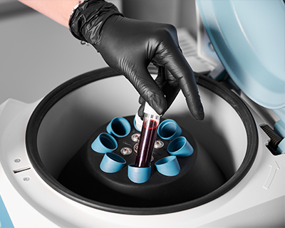 best-spine-surgeon-shivam-hospital